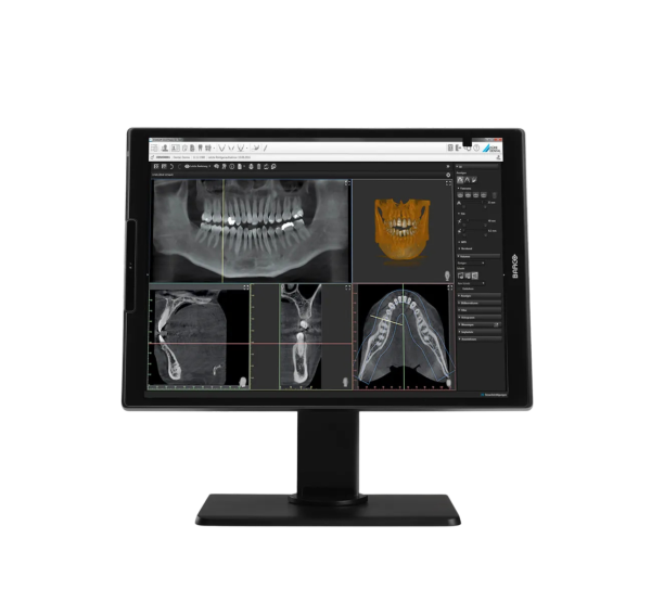 Barco Nio Color 3MP Dental – MDNC-3521