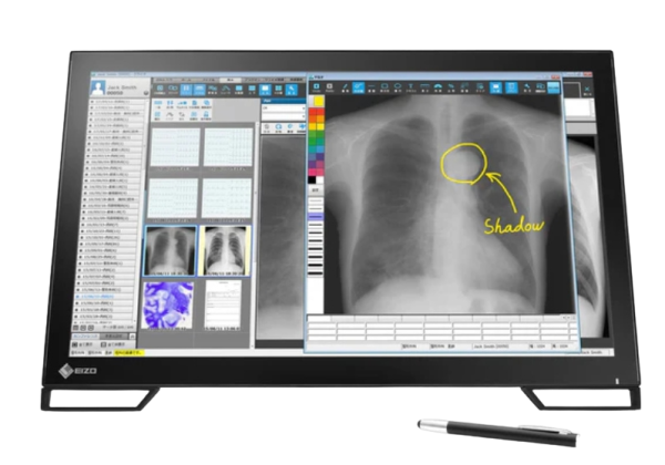EIZO RadiForce MS236WT-A