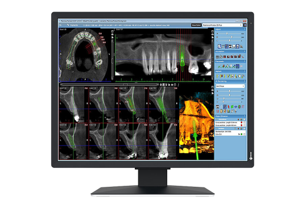 EIZO RadiForce MX217-HB