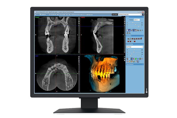 EIZO RadiForce MX217-SB