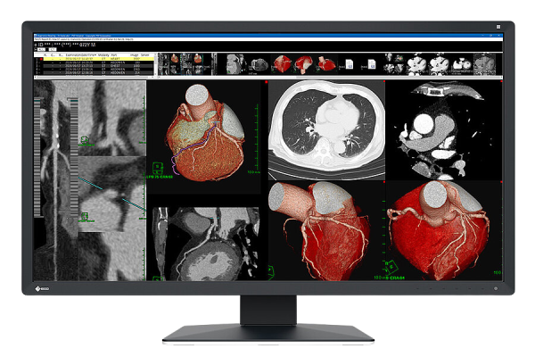 EIZO RadiForce MX317W