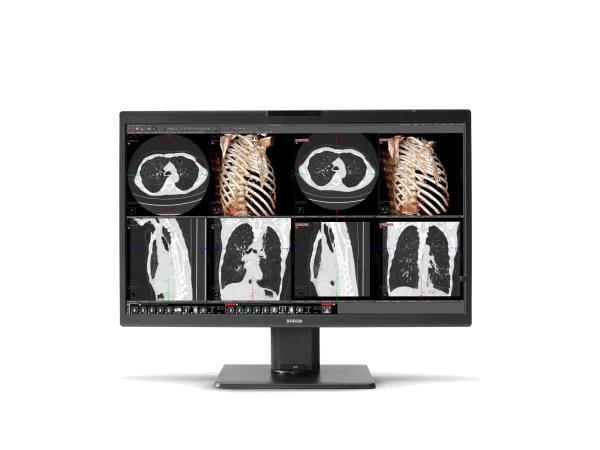 Nio Color 8MP – MDNC-8132