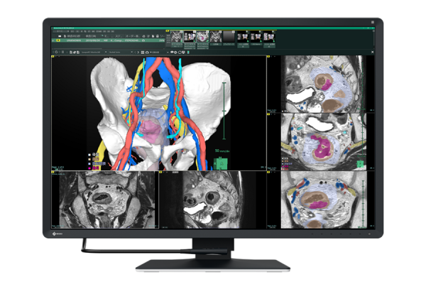 EIZO RadiForce RX670